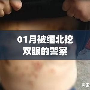 緬北警察遭遇暴力襲擊，雙眼被挖事件回顧
