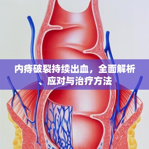 內痔破裂持續(xù)出血，全面解析、應對與治療方法