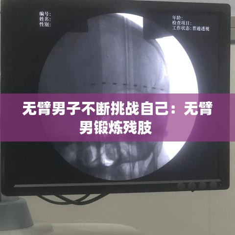 無(wú)臂男子不斷挑戰(zhàn)自己：無(wú)臂男鍛煉殘肢 