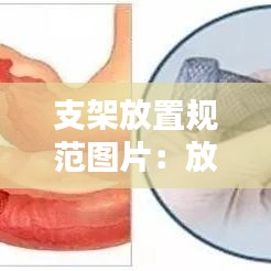 支架放置規(guī)范圖片：放支架技術要求 