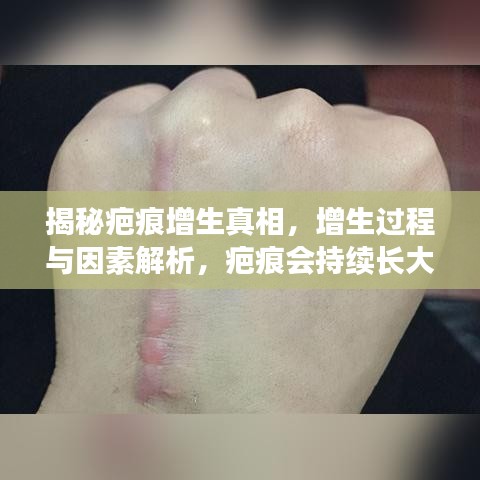 揭秘疤痕增生真相，增生過程與因素解析，疤痕會持續(xù)長大嗎？