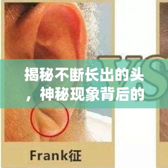 揭秘不斷長(zhǎng)出的頭，神秘現(xiàn)象背后的醫(yī)學(xué)探索之旅