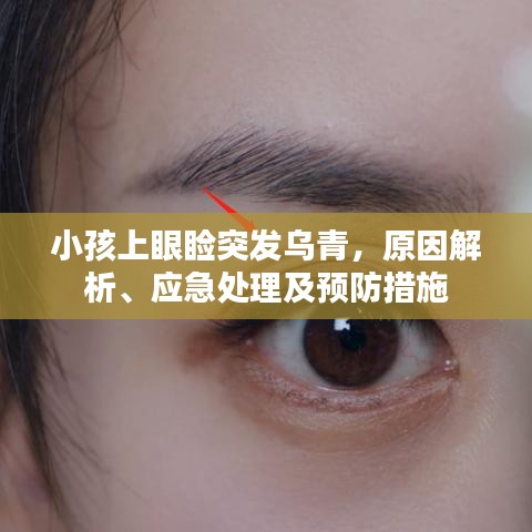 小孩上眼瞼突發(fā)烏青，原因解析、應(yīng)急處理及預(yù)防措施